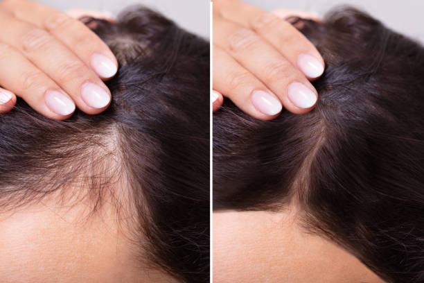 Intense Repair Hair Serum