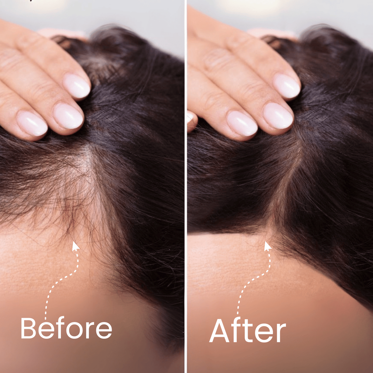 Hair Growth Kit Deal